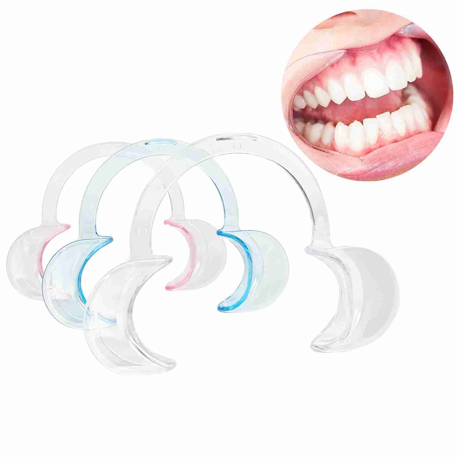 Professional Mouth Opener for Whitening Procedures